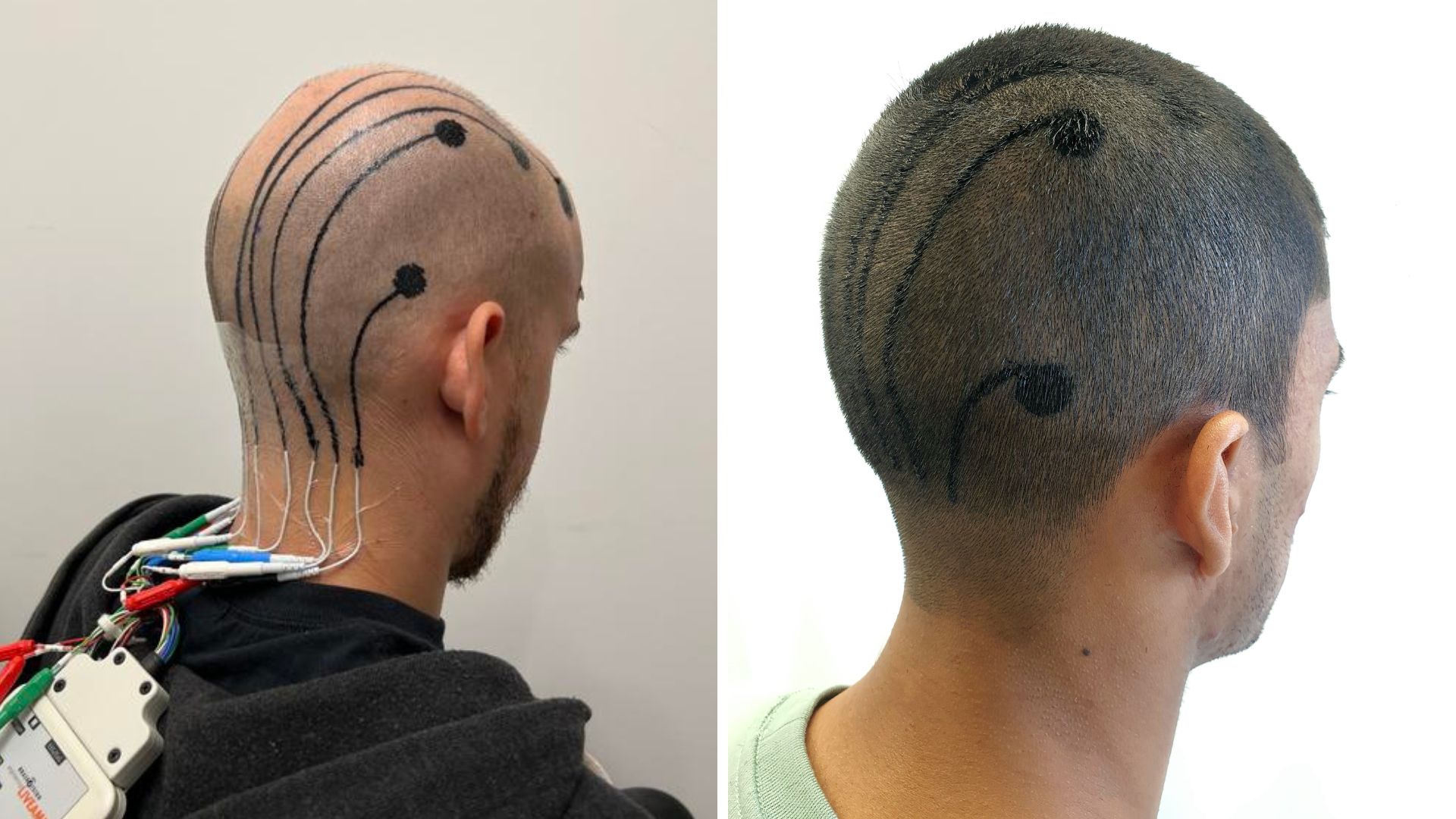 Skin-printed e-tattoos offer accurate, comfortable brain monitoring [Video]