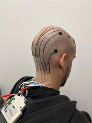 Scientists invent hair-friendly solution for measuring brainwaves [Video]