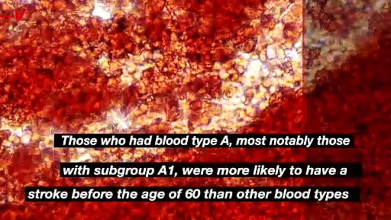 Why This Blood Type Has a Higher Risk of Stroke [Video]